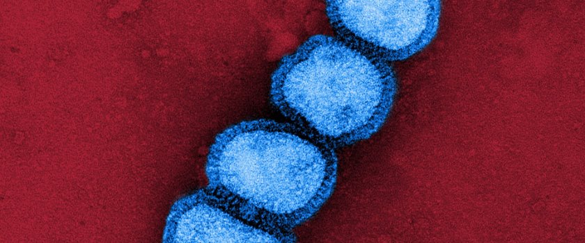 Influenza A/H1N1 virus particles, colourised transmission electron micrograph